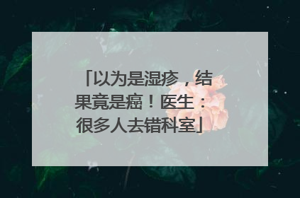 以为是湿疹，结果竟是癌！医生：很多人去错科室